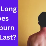 How Long Does Sunburn Itch Last?